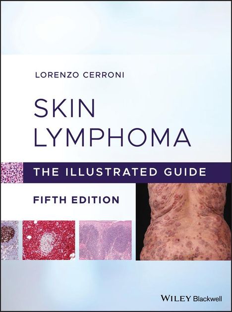 Lorenzo Cerroni: Skin Lymphoma, Buch
