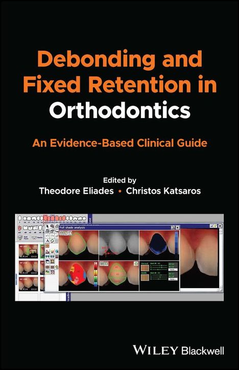 T Eliades: Debonding and Fixed Retention in Orthodontics: An Evidence-Based Clinical Guide, Buch