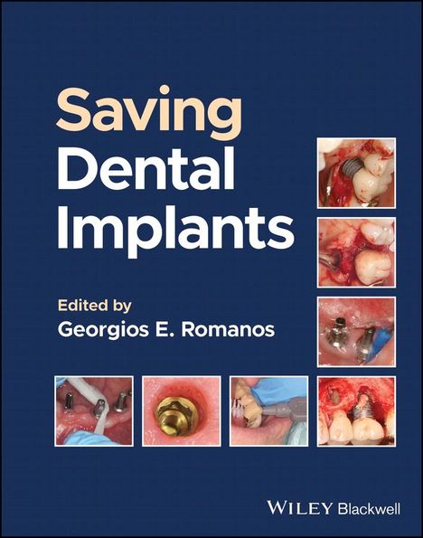 Saving Dental Implants, Buch