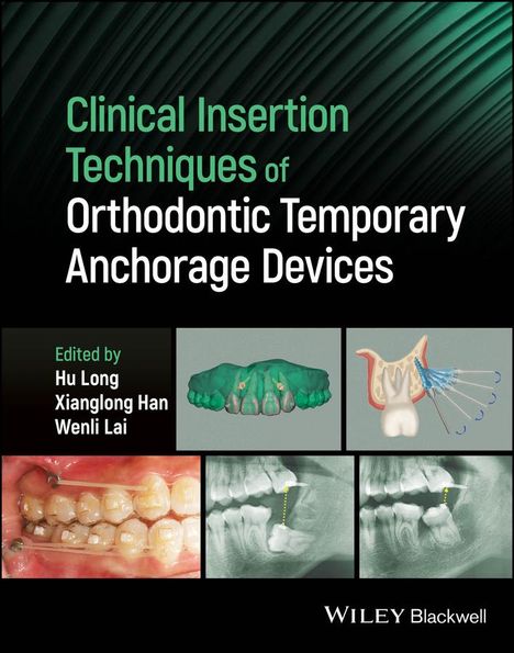 Clinical Insertion Techniques of Orthodontic Temporary Anchorage Devices, Buch