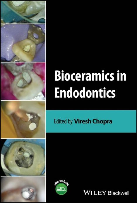 Bioceramics in Endodontics, Buch