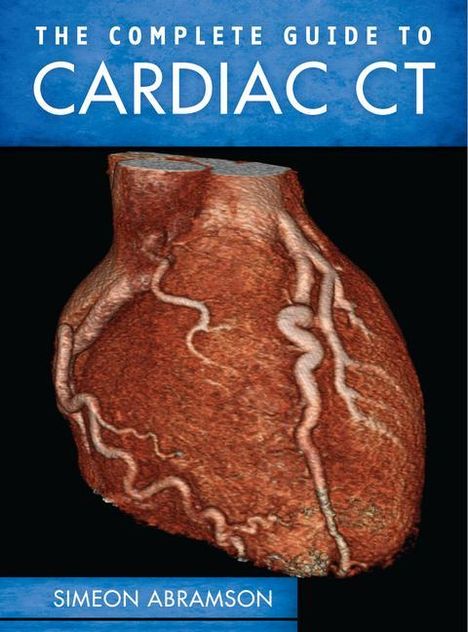Simeon Abramson: The Complete Guide to Cardiac CT (Pb), Buch