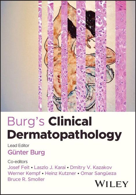 Text: "Burg's Clinical Dermatopathology", "Lead Editor: Günter Burg", "Co-editors: Josef Feit, Laszlo J. Karai, Dmitry V. Kazakov, Werner Kempf, Heinz Kutzner, Omar Sangüeza, Bruce R. Smoller". 

Eine Kombination aus Illustration und Mikroskop-Bild von Hautgewebe.