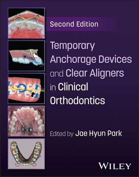 "Second Edition, Temporary Anchorage Devices and Clear Aligners in Clinical Orthodontics, Edited by Jae Hyun Park." Links anatomische Illustrationen.