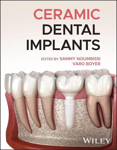 "Ceramic Dental Implants, edited by Sammy Noumbissi, Varo Boyer." Illustration eines Zahns mit Keramikimplantat.
