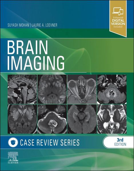 Suyash Mohan: Brain Imaging Case Review, Buch