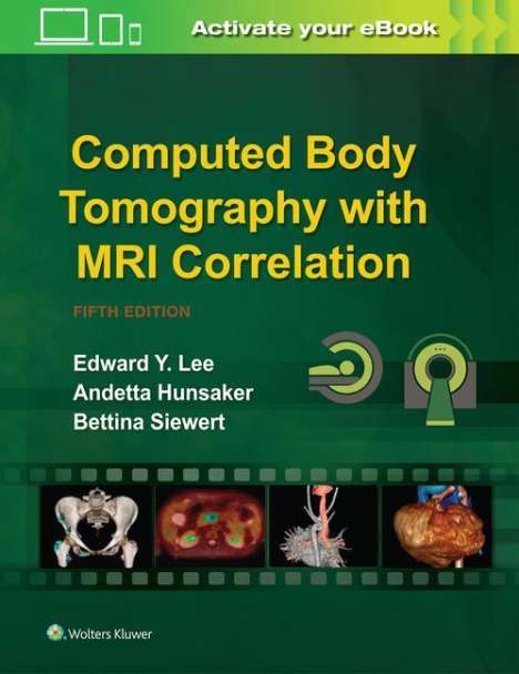 Edward Y. Lee: Lee, E: Computed Body Tomography with MRI Correlation, Buch