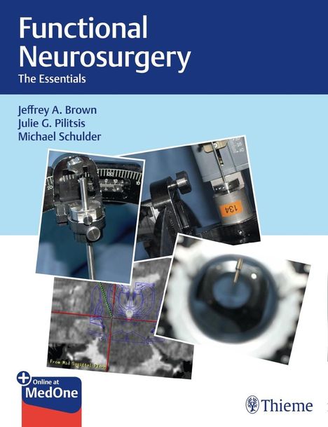 Michael Schulder: Brown, J: Functional Neurosurgery, Diverse