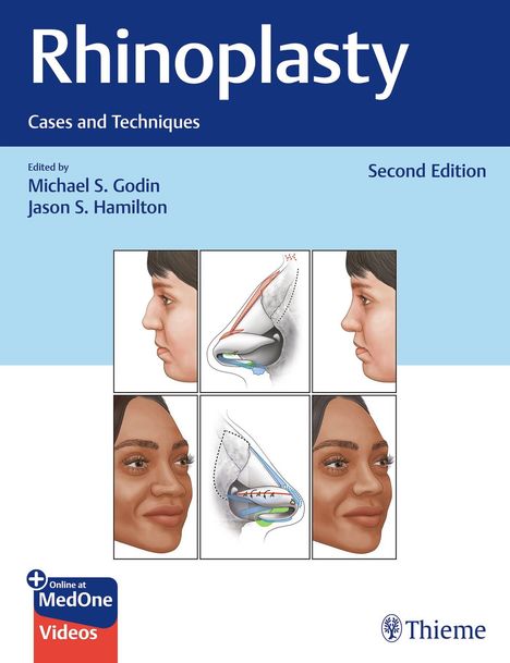 Michael S. Godin: Rhinoplasty, 1 Buch und 1 Diverse