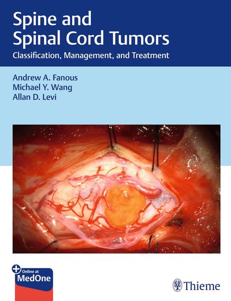 Andrew Fanous: Spine and Spinal Cord Tumors, 1 Buch und 1 Diverse