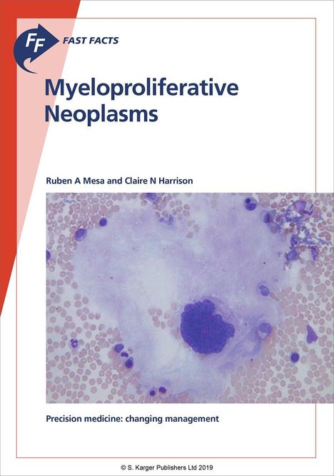 Ruben A. Mesa: Mesa, R: Fast Facts: Myeloproliferative Neoplasms, Buch