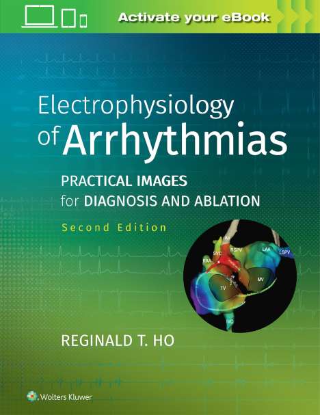 Reginald T. Ho: Electrophysiology of Arrhythmias, Buch