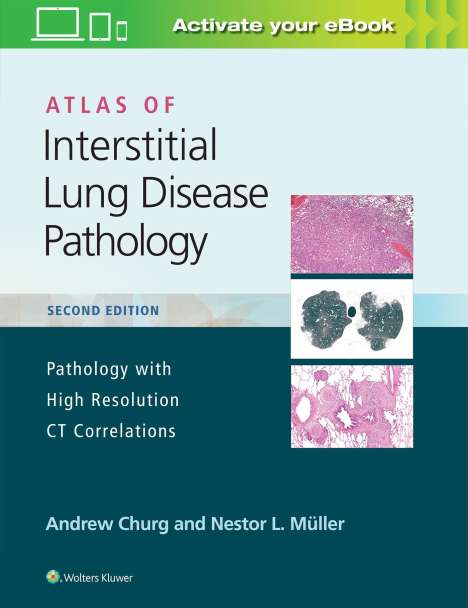 Andrew Churg: Atlas of Interstitial Lung Disease Pathology, Buch
