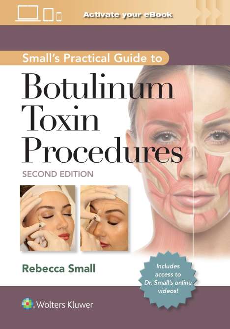 A Practical Guide to Botulinum Toxin Procedures, Buch