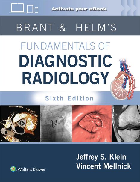 Jeffrey Klein: Brant &amp; Helm's Fundamentals of Diagnostic Radiology: Print + eBook with Multimedia, Buch