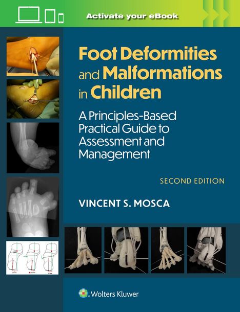 Vincent Mosca: Foot Deformities and Malformations in Children, Buch