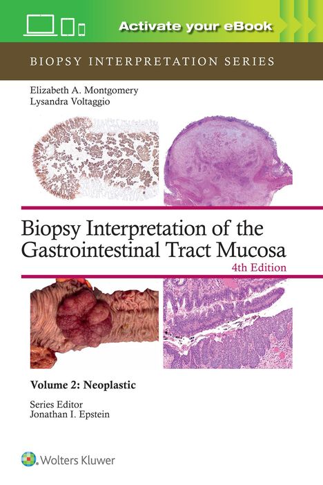 Elizabeth Anne Montgomery: Biopsy Interpretation of the Gastrointestinal Tract Mucosa Volume 2, Buch