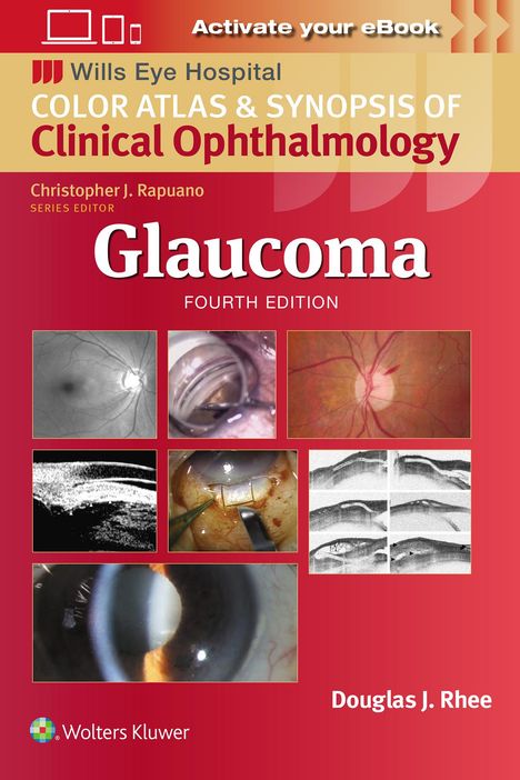 Douglas J. Rhee: Glaucoma, Buch