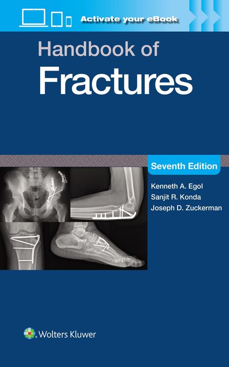 Kenneth A. Egol: Handbook of Fractures: Print + eBook with Multimedia, Buch