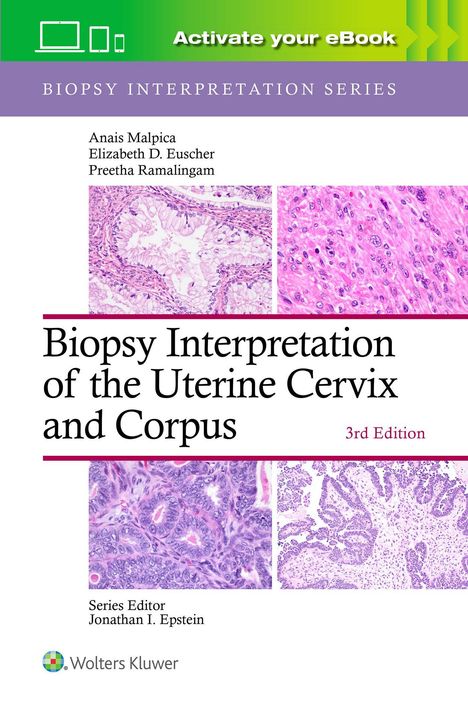 Titel: "Biopsy Interpretation of the Uterine Cervix and Corpus", 3. Ausgabe. Autoren: Anais Malpica, Elizabeth D. Euscher, Preetha Ramalingam. Oben ein grünes Banner mit Schrift. Illustration von Gewebeproben in Rosatönen.