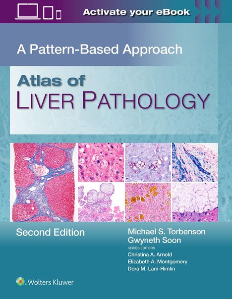 "Activate your eBook" oben; "A Pattern-Based Approach"; "Atlas of Liver Pathology"; "Second Edition" links; Autoren unten.