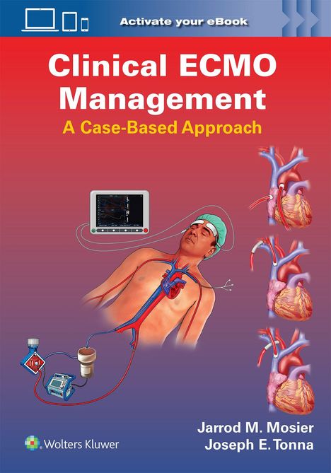 Cover für "Clinical ECMO Management: A Case-Based Approach". Illustration eines Patienten mit medizinischer Ausrüstung.