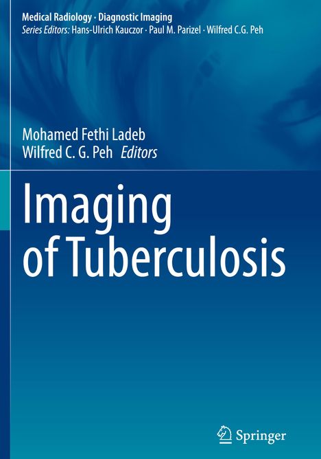 Imaging of Tuberculosis, Buch
