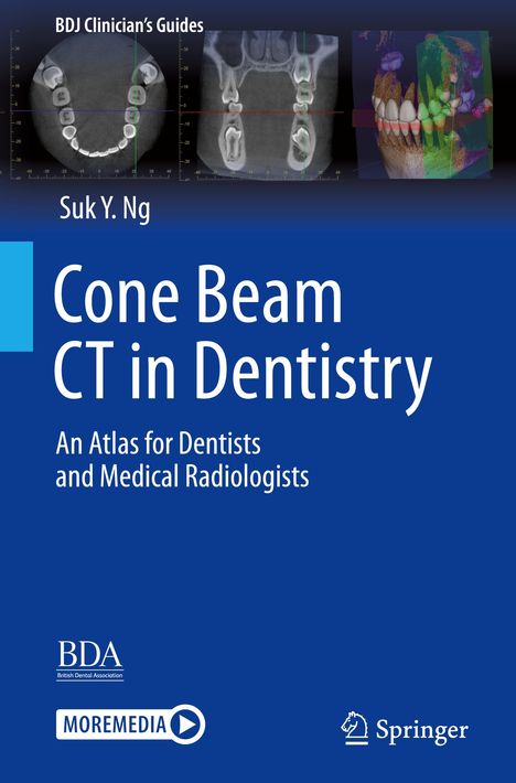 Suk Y. Ng: Cone Beam CT in Dentistry, Buch