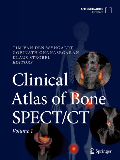 Clinical Atlas of Bone SPECT/CT, 2 Bücher