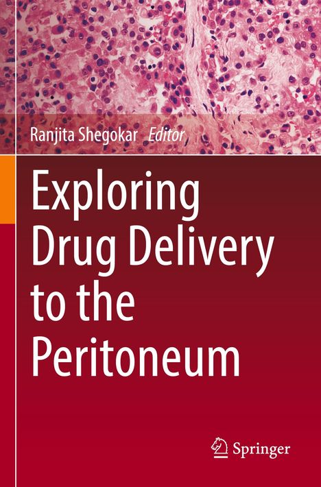 Exploring Drug Delivery to the Peritoneum, Buch