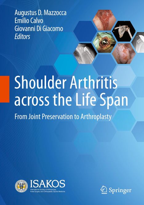 Shoulder Arthritis across the Life Span, Buch