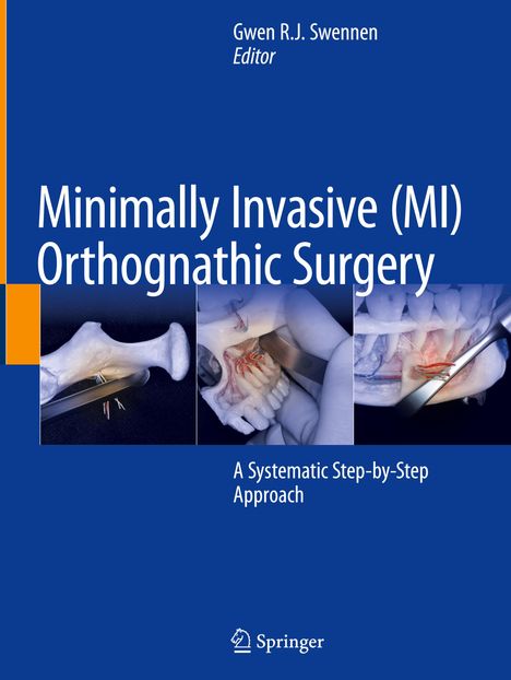 Minimally Invasive (MI) Orthognathic Surgery, Buch