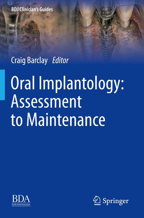 "Oral Implantology: Assessment to Maintenance, Craig Barclay, Editor." Oben: Zahnimplantat-Illustration. Unten: BDA, Springer.