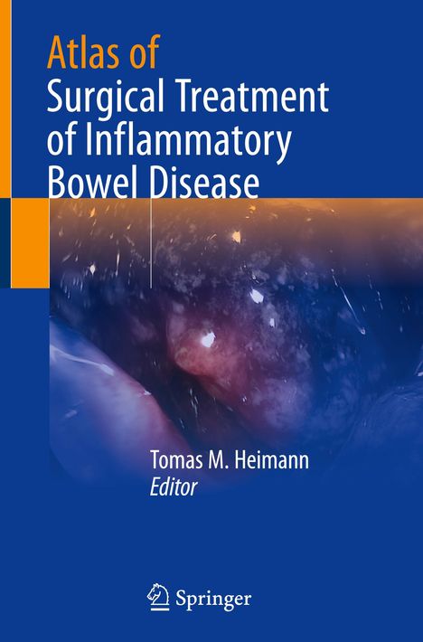 Atlas of Surgical Treatment of Inflammatory Bowel Disease, Buch