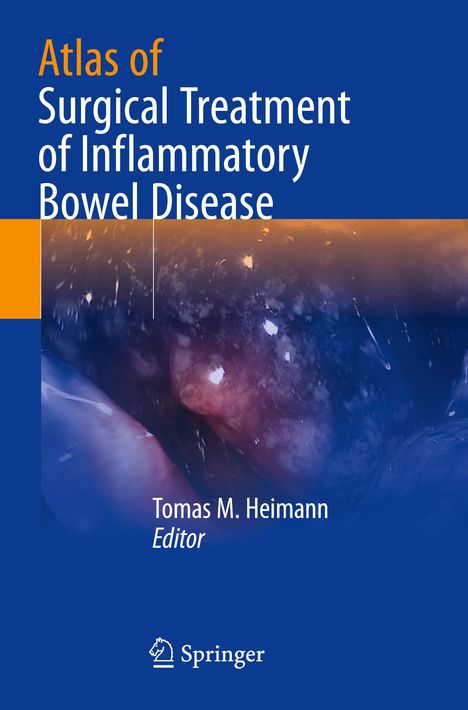 Text: "Atlas of Surgical Treatment of Inflammatory Bowel Disease" und "Tomas M. Heimann, Editor". Logo unten: Springer.