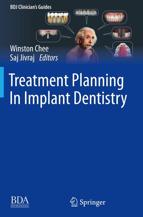 Treatment Planning In Implant Dentistry, Buch