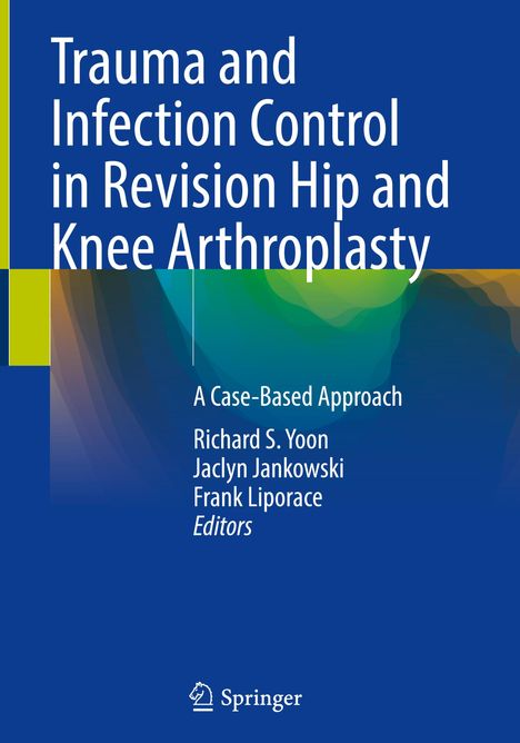 Trauma and Infection Control in Revision Hip and Knee Arthroplasty, Buch