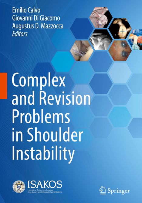Complex and Revision Problems in Shoulder Instability, Buch