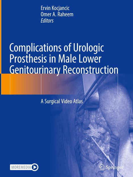 Complications of Urologic Prosthesis in Male Lower Genitourinary Reconstruction, Buch