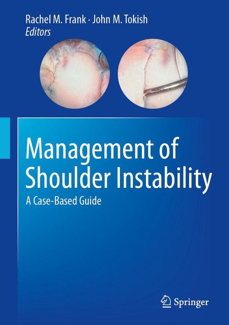"Management of Shoulder Instability: A Case-Based Guide." Oben zwei kreisförmige medizinische Bilder. Springer-Logo unten.
