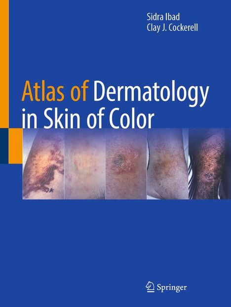 Text: "Atlas of Dermatology in Skin of Color." Autoren: Sidra Ibad, Clay J. Cockerell. Unten Springer-Logo. Bilder von Hautzuständen.