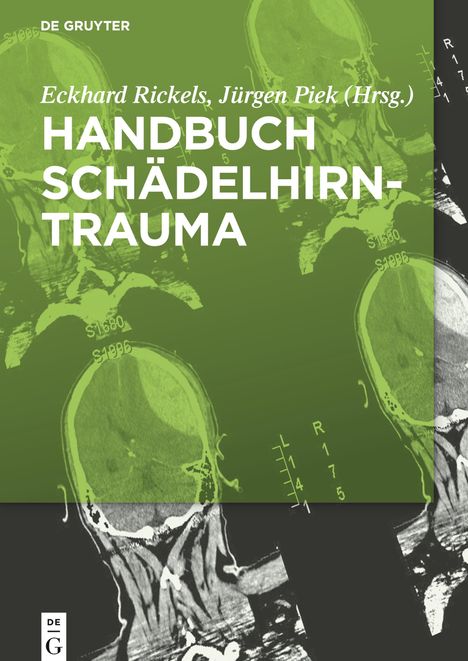 Handbuch Schädelhirntrauma, Buch