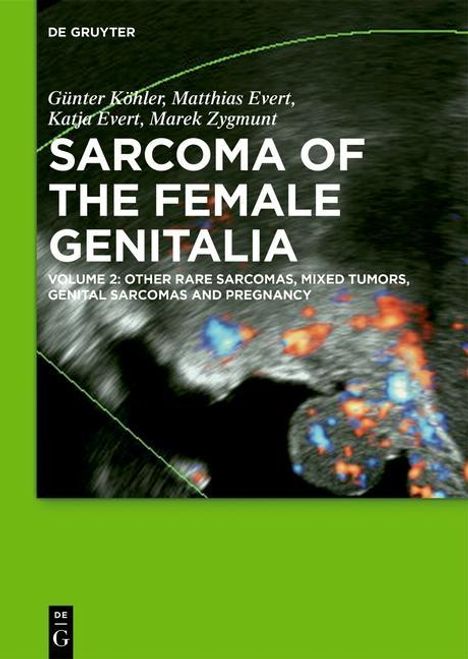 Günter Köhler: Sarcoma of the Female Genitalia / [Set Vol. I+II] Bd. Volume 1+2, Buch