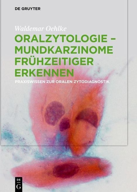 Waldemar Oehlke: Oralzytologie - Mundkarzinome frühzeitiger erkennen, Buch