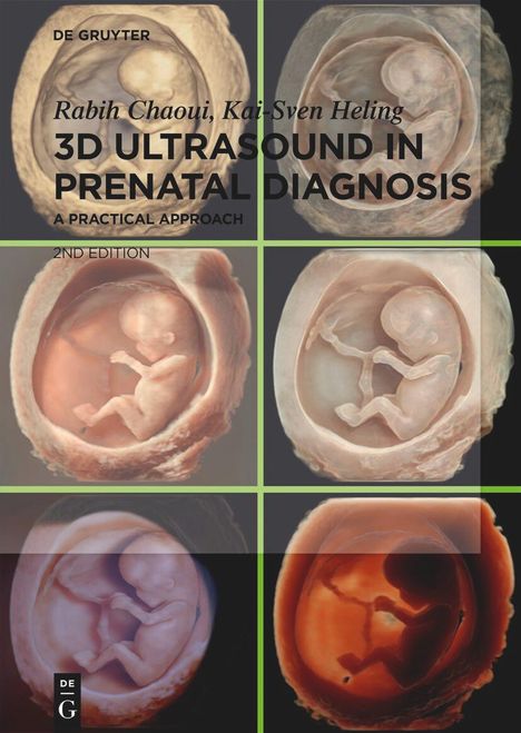 Rabih Chaoui: 3D Ultrasound in Prenatal Diagnosis, Buch