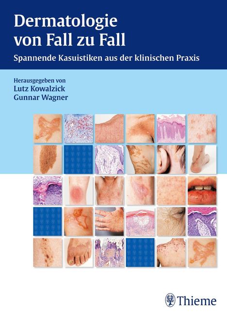 Kowalzick, L: Dermatologie von Fall zu Fall, Buch