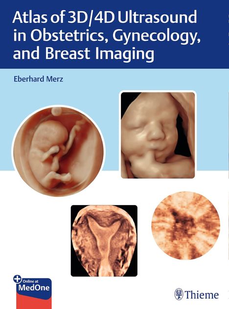 Eberhard Merz: Atlas of 3D/4D Ultrasound in Obstetrics, Gynecology, and Breast Imaging, Buch