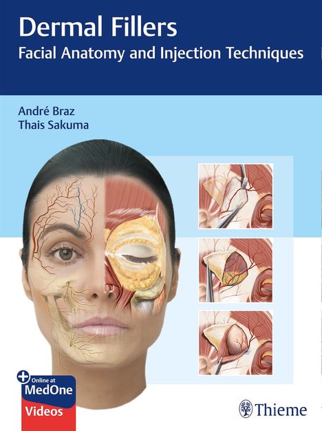 André Vieira Braz: Dermal Fillers, 1 Buch und 1 Diverse