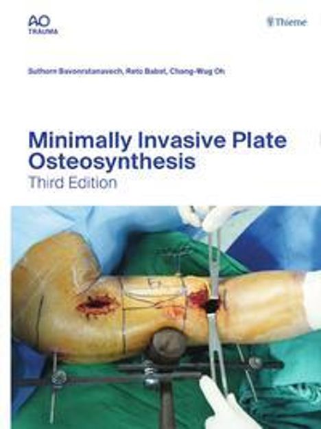 Minimally Invasive Plate Osteosynthesis, 1 Buch und 1 Diverse