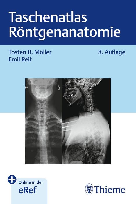 Torsten Bert Möller: Taschenatlas Röntgenanatomie, 1 Buch und 1 Diverse